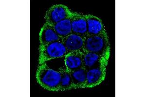 Confocal immunofluorescent analysis of CLCN7 Antibody (C-term) (ABIN655808 and ABIN2845235) with WiDr cell followed by Alexa Fluor 488-conjugated goat anti-rabbit lgG (green). (CLCN7 抗体  (C-Term))