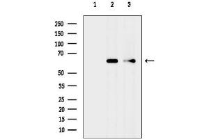 Western blot analysis of lysates from various samples, using Cytochrome P450 4F11 Antibody.