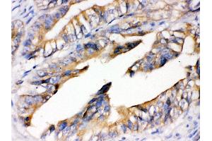 Immunohistochemistry (IHC) image for anti-Advanced Glycosylation End Product-Specific Receptor (AGER) (AA 91-120), (N-Term) antibody (ABIN3043529)