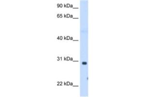 Western Blotting (WB) image for anti-ST3 beta-Galactoside alpha-2,3-Sialyltransferase 3 (ST3GAL3) antibody (ABIN2463000) (ST3GAL3 抗体)