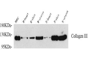 Western Blot analysis of various samples using COL3A1 Polyclonal Antibody at dilution of 1:750. (COL3A1 抗体)