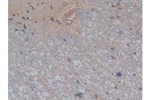 DAB staining on IHC-P; Samples: Rat Spinal cord Tissue (Kallikrein 4 抗体  (AA 32-256))