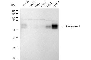 Western blotting analysis using Beta-Secretase 1 antibody (ABIN7797765). (Recombinant BACE1 抗体)