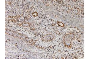 IHC analysis of EHD1 using anti-EHD1 antibody (ABIN6719599).
