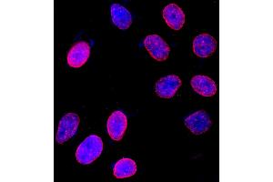 anti-Nucleoporin 153kDa (NUP153) (AA 50-100) antibody