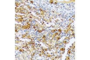 Immunohistochemistry of paraffin-embedded rat ovary using CF antibody (3087) at dilution of 1:100 (40x lens). (A1CF 抗体  (AA 50-120))
