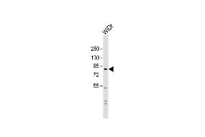 Anti-SUSD2 Antibody (C-term) at 1:1000 dilution + WiDr whole cell lysate Lysates/proteins at 20 μg per lane. (SUSD2 抗体  (C-Term))