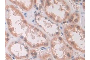 Detection of IL12A in Human Kidney Tissue using Monoclonal Antibody to Interleukin 12A (IL12A) (IL12A 抗体  (AA 23-219))