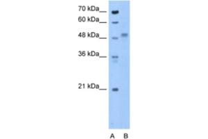 Western Blotting (WB) image for anti-Zona Pellucida Glycoprotein 4 (ZP4) antibody (ABIN2463282) (ZP4 抗体)