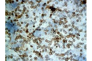 Immunohistochemistry (IHC) image for anti-Apoptotic Peptidase Activating Factor 1 (APAF1) (AA 1201-1248) antibody (ABIN724295) (APAF1 抗体  (AA 1201-1248))