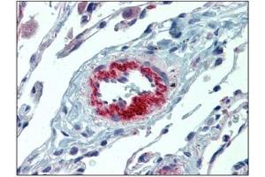 Immunohistochemistry (IHC) image for anti-Interleukin 23, alpha subunit p19 (IL23A) antibody (ABIN614363) (IL23A 抗体)