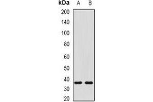 Western blot analysis of SHOX2 expression in NIH3T3 (A), mouse liver (B) whole cell lysates. (SHOX2 抗体)