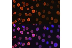 Immunofluorescence analysis of NIH-3T3 cells using Acetyl-Histone H4-K5 antibody (ABIN7267743).