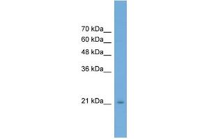 WB Suggested Anti-RAB25 Antibody Titration: 0. (RAB25 抗体  (Middle Region))