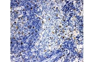 IHC-P: IRAK2 antibody testing of rat spleen tissue (IRAK2 抗体  (C-Term))