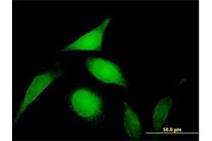 Immunofluorescence (IF) image for anti-Proteasome (Prosome, Macropain) 26S Subunit, Non-ATPase, 14 (PSMD14) (AA 1-310) antibody (ABIN948909)