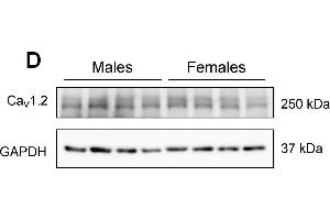 Western blot showing CaV1.