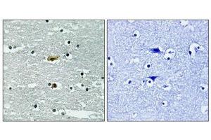 Immunohistochemical analysis of paraffin-embedded human brain tissue using STK39 (Phospho-Ser309) antibody (left)or the same antibody preincubated with blocking peptide (right). (STK39 抗体  (pSer311))