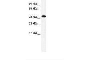 Image no. 1 for anti-Zinc Finger Protein 568 (ZNF568) (AA 143-192) antibody (ABIN6735990) (ZNF568 抗体  (AA 143-192))