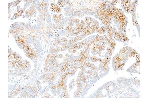 anti-Syndecan 1 (SDC1) (AA 23-251) antibody