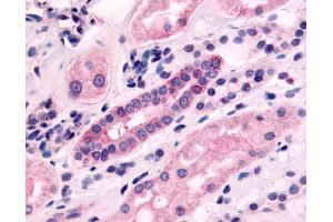 Anti-5HT1F Receptor antibody IHC of human kidney, renal tubules. (HTR1F 抗体  (N-Term))