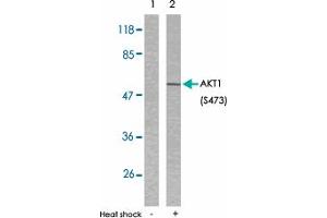 Western blot analysis of extracts from HeLa cells untreated or treated with heat shock using AKT1 (phospho S473) polyclonal antibody . (AKT1 抗体  (pSer473))