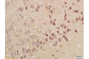 Formalin-fixed and paraffin embedded rat brain labeled with Anti-GRP78 Polyclonal Antibody, Unconjugated (ABIN673554) followed by conjugation to the secondary antibody and DAB staining (GRP78 抗体  (AA 251-360))