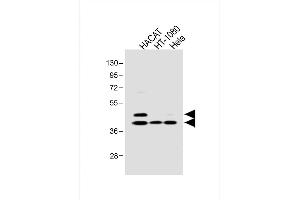 All lanes : Anti-SD3 Antibody at 1:1000 dilution Lane 1: HACAT whole cell lysate Lane 2: HT-1080 whole cell lysate Lane 3: Hela whole cell lysate Lysates/proteins at 20 μg per lane. (SMAD3 抗体  (pSer213))