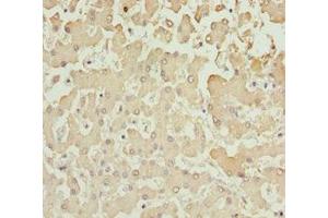 Immunohistochemistry of paraffin-embedded human liver tissue using ABIN7143586 at dilution of 1:100 (AKR7A2 抗体  (AA 100-359))