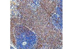 IHC analysis of SYK using anti-SYK antibody (ABIN7599608).