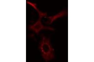ABIN6277654 staining HeLa cells by IF/ICC. (MLKL 抗体  (Internal Region))