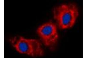 Immunofluorescent analysis of Cadherin 23 staining in HEK293T cells. (CDH23 抗体  (N-Term))