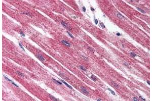 Immunohistochemistry (Formalin/PFA-fixed paraffin-embedded sections) of human heart tissue with EDNRA polyclonal antibody . (Endothelin-1 Receptor 抗体  (Extracellular Domain))