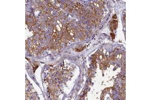 Immunohistochemical staining of human testis with SLC26A10 polyclonal antibody  shows strong cytoplasmic positivity in cells in seminiferus ducts and Leydig cells at 1:200-1:500 dilution. (SLC26A10 抗体)