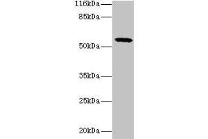 Western blot All lanes: GDAP2 antibody at 2 μg/mL + MCF-7 whole cell lysate Secondary Goat polyclonal to rabbit IgG at 1/10000 dilution Predicted band size: 57 kDa Observed band size: 57 kDa (GDAP2 抗体  (AA 1-496))