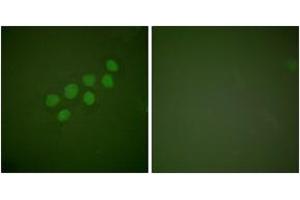 Immunofluorescence analysis of A549 cells, using SKP2/p45 Antibody. (SKP2 抗体  (AA 366-415))