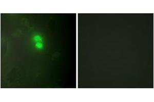 Immunofluorescence analysis of HeLa cells, using Dyskerin Antibody. (DKC1 抗体  (AA 171-220))