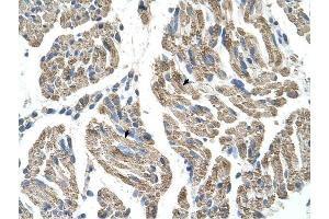 SLC25A38 antibody was used for immunohistochemistry at a concentration of 4-8 ug/ml to stain Skeletal muscle cells (arrows) in Human Muscle. (SLC25A38 抗体  (Middle Region))