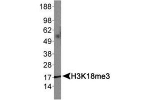 Western Blotting (WB) image for anti-Histone 3 (H3) (3meLys18) antibody (ABIN5706756)