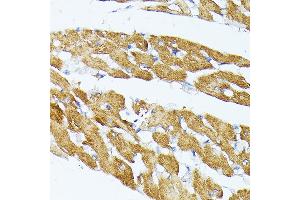 Immunohistochemistry of paraffin-embedded Rat brain using TR antibody (ABIN1683134, ABIN5664756, ABIN5664758 and ABIN6220605) at dilution of 1:100 (40x lens). (TRAP1 抗体  (AA 445-704))