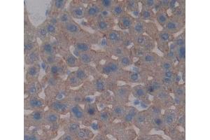 Immunohistochemistry (IHC) image for anti-ATP-Binding Cassette, Sub-Family G (WHITE), Member 5 (ABCG5) (AA 66-276) antibody (ABIN7445135)