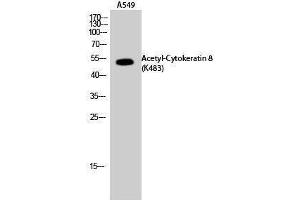 Western Blotting (WB) image for anti-Keratin 8 (KRT8) (acLys483) antibody (ABIN6285500) (KRT8 抗体  (acLys483))