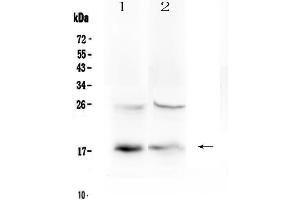 Western blot analysis of TSLP using anti-TSLP antibody . (Thymic Stromal Lymphopoietin 抗体)