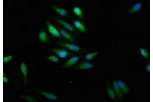 Immunofluorescence (IF) image for anti-Sodium Channel, Voltage-Gated, Type IX, alpha Subunit (SCN9A) (AA 1849-1988) antibody (ABIN7169929)