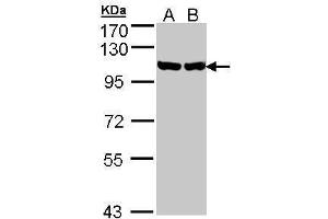 GRP94 抗体  (Center)