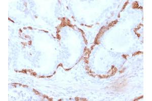 Immunohistochemistry (IHC) image for anti-Keratin 14 (KRT14) (AA 351-472) antibody (ABIN6939908)