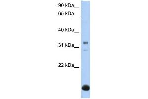 B3GALT6 antibody used at 1 ug/ml to detect target protein. (B3GALT6 抗体  (N-Term))