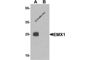 Western Blotting (WB) image for anti-Empty Spiracles Homeobox 1 (EMX1) (N-Term) antibody (ABIN1031368)