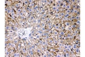 Immunohistochemistry (IHC) image for anti-Solute Carrier Family 10 (Sodium/bile Acid Cotransporter Family), Member 1 (SLC10A1) antibody (ABIN4951952)