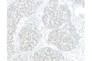 anti-Holliday Junction Recognition Protein (HJURP) (AA 650-700) antibody